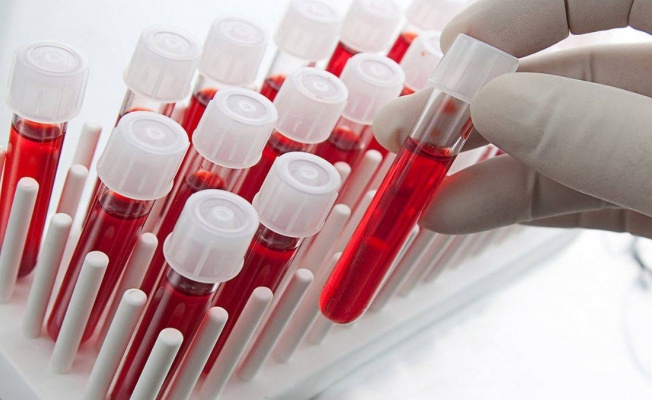 Araştırma: Yeni kan testi, on kanser ölümünden birini durdurabilir