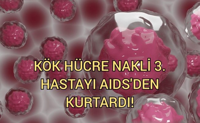 Lösemi tedavisi için yapılan kök hücre nakli 3. hastayı da AIDS'ten kurtardı