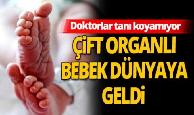 6 milyonda 1 görülüyor! İki cinsel organla dünyaya geldi... Tek anormallik bu değil