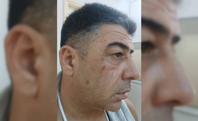 Parasını isteyen taksici ciddi şekilde darp edildi!