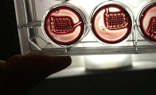 “Hastaların kanıyla kırık kemikleri tedavi edecek” implant geliştirildi