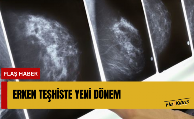 Yapay zeka, meme kanseri riskini yıllar öncesinden tahmin edebiliyor