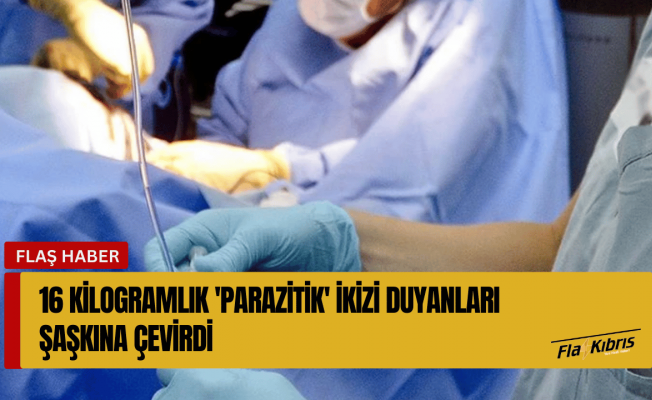 Hindistan'da bir kızın vücudundan 16 kilogramlık 'parazitik' ikiz çıkarıldı