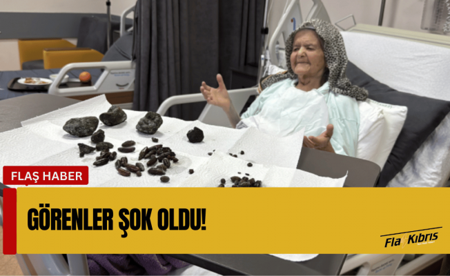 Midesinden 28 hurma, 35 zeytin çekirdeği ve 5 taş çıktı