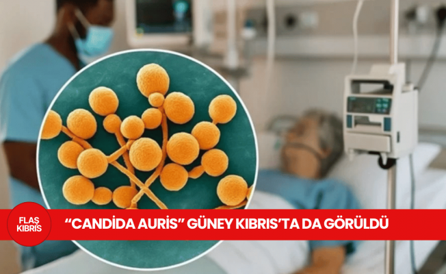 Yayılımı Avrupa’da endişe yaratan “candida auris” Güney Kıbrıs’ta da görüldü