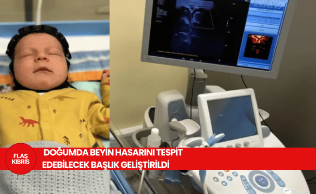 İngiltere'de bilim insanları doğumda beyin hasarını tespit edebilecek başlık geliştirdi