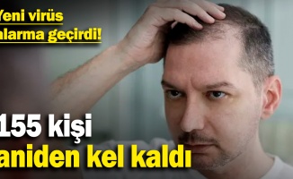 155 kişi aniden kel kaldı: Hindistan’da saç döken gizemli salgın!