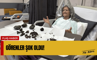 Midesinden 28 hurma, 35 zeytin çekirdeği ve 5 taş çıktı