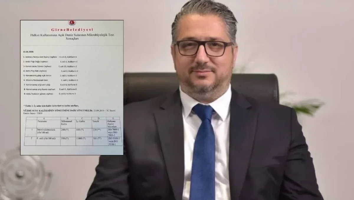 Murat Şenkul: Plajlarımızın temizliği bilimsel verilerle ortadadır